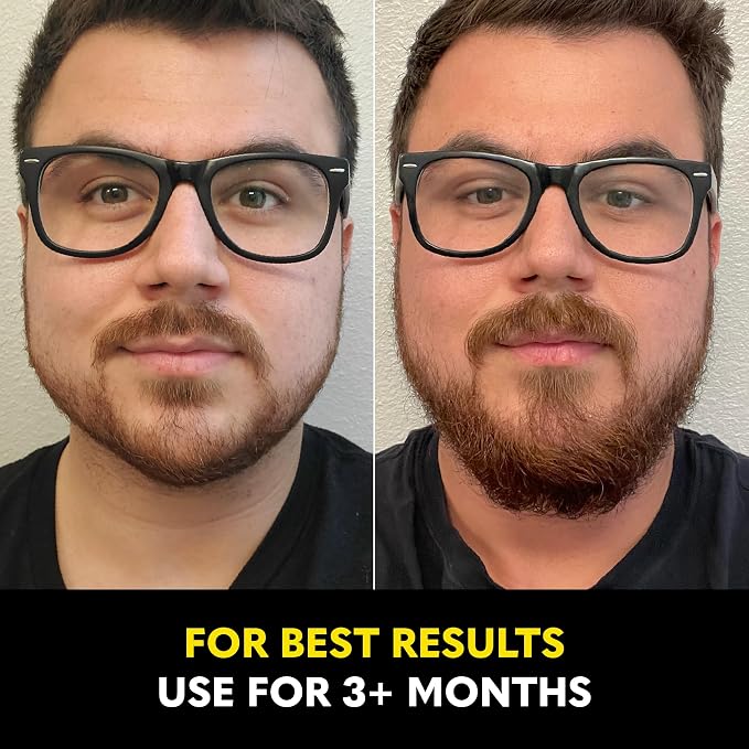 Beard Growth Oil