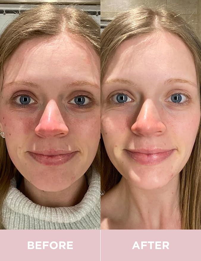 __DEFAULT__